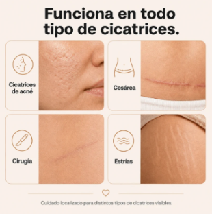 Stick de silicona para cicatrices y estrías