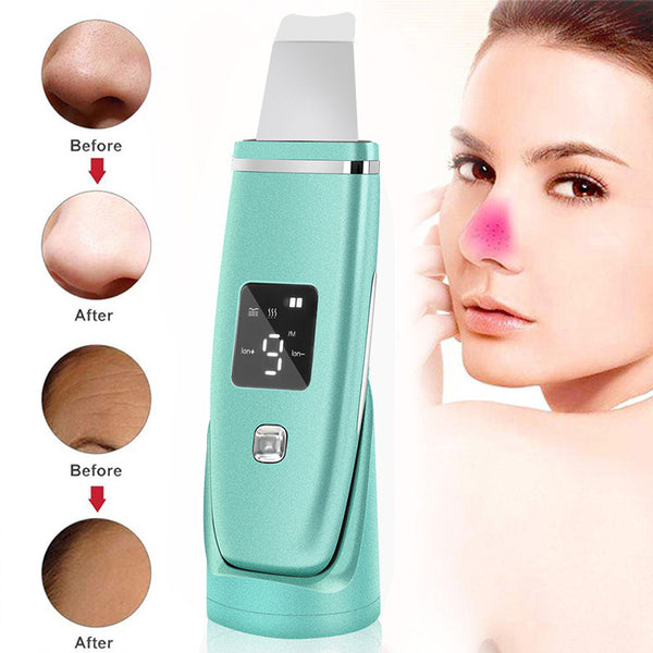 Ultrasonic Vibration Blackhead Remover Deep